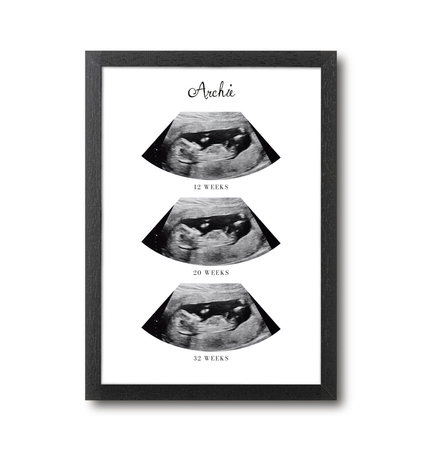 Personalised Photo Up-load Ultrasound Print
