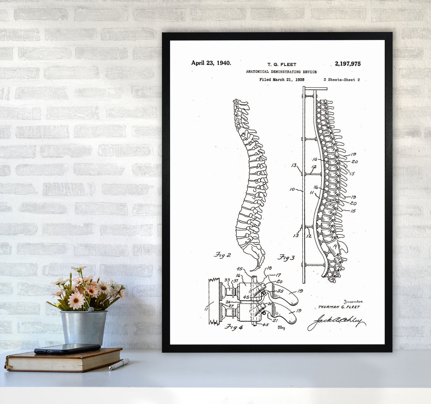 Anatomical Spine Display Patent Art Print by Jason Stanley A1 White Frame