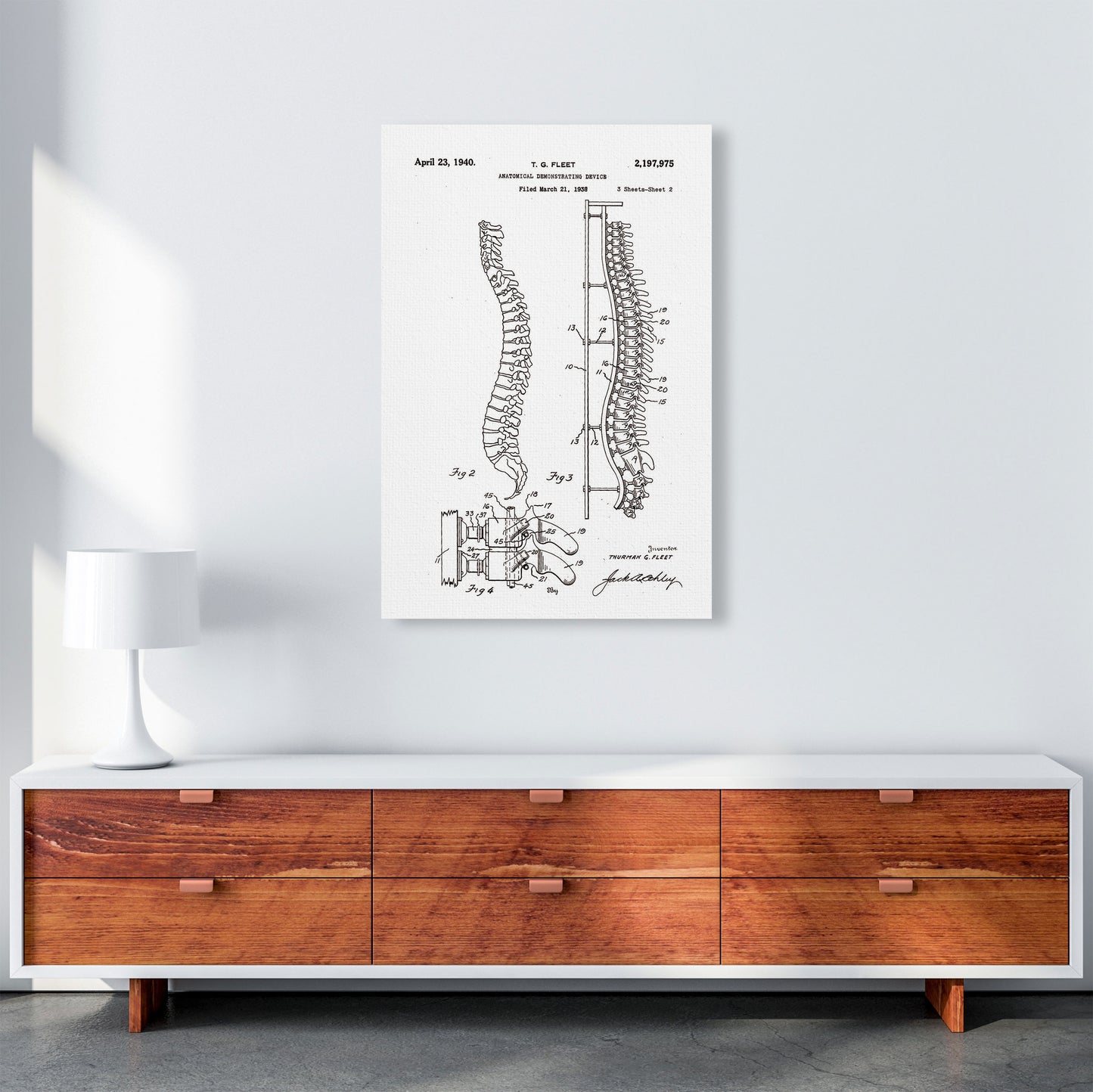 Anatomical Spine Display Patent Art Print by Jason Stanley A1 Canvas
