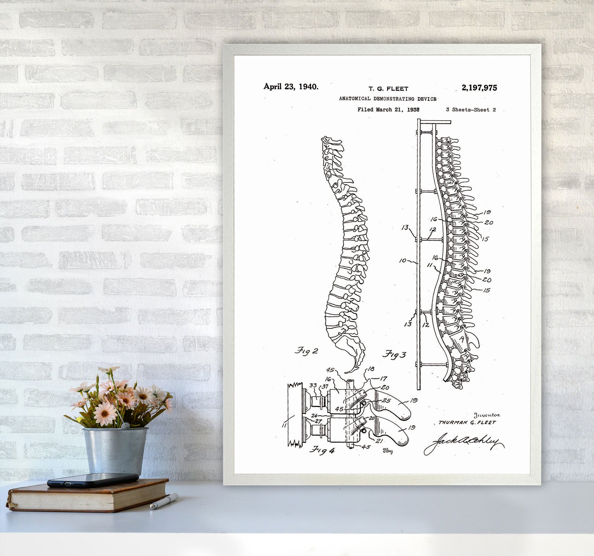 Anatomical Spine Display Patent Art Print by Jason Stanley A1 Oak Frame