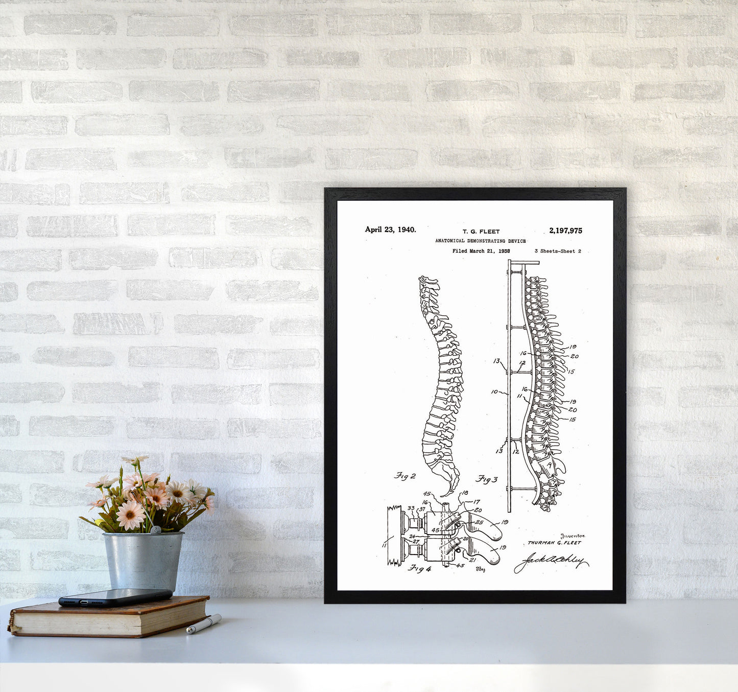 Anatomical Spine Display Patent Art Print by Jason Stanley A2 White Frame