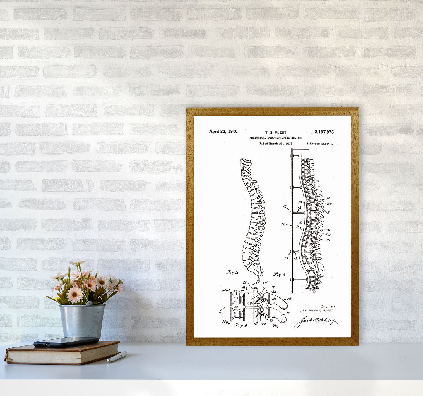 Anatomical Spine Display Patent Art Print by Jason Stanley A2 Print Only