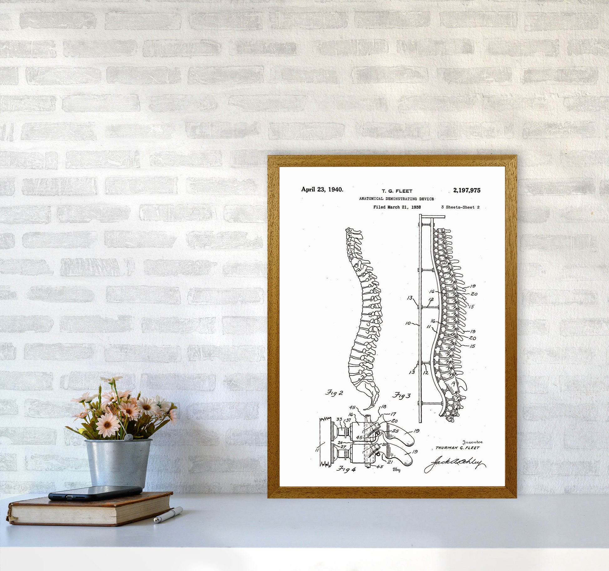 Anatomical Spine Display Patent Art Print by Jason Stanley A2 Print Only