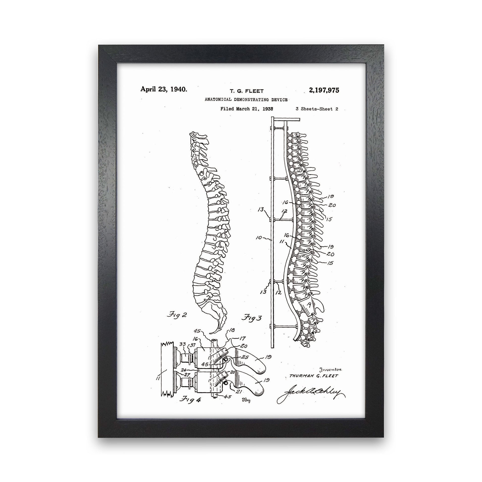 Anatomical Spine Display Patent Art Print by Jason Stanley Black Grain