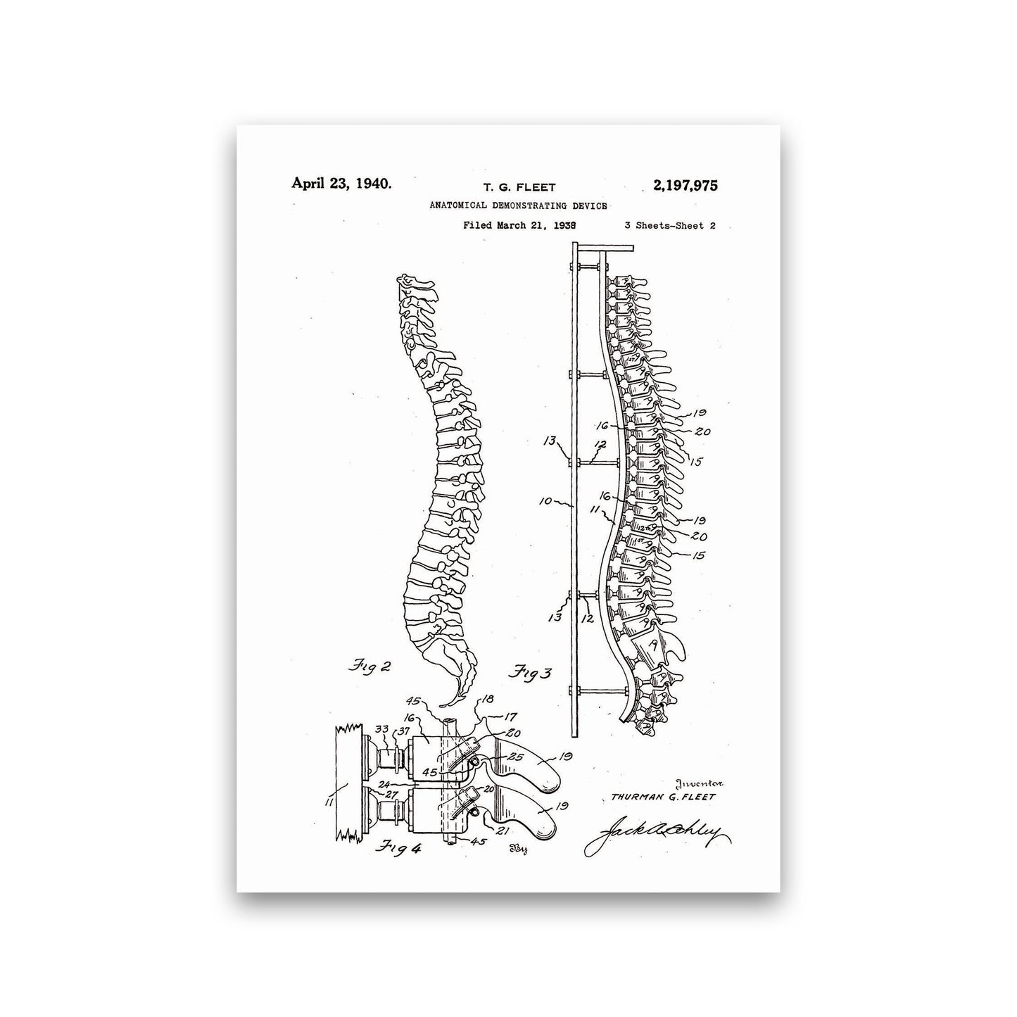 Anatomical Spine Display Patent Art Print by Jason Stanley Print Only