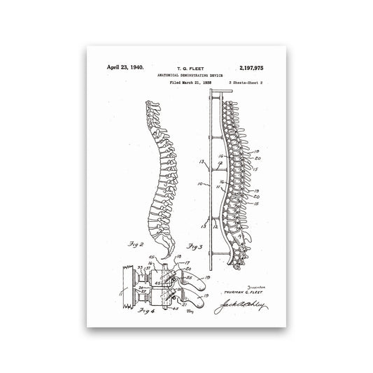 Anatomical Spine Display Patent Art Print by Jason Stanley Print Only