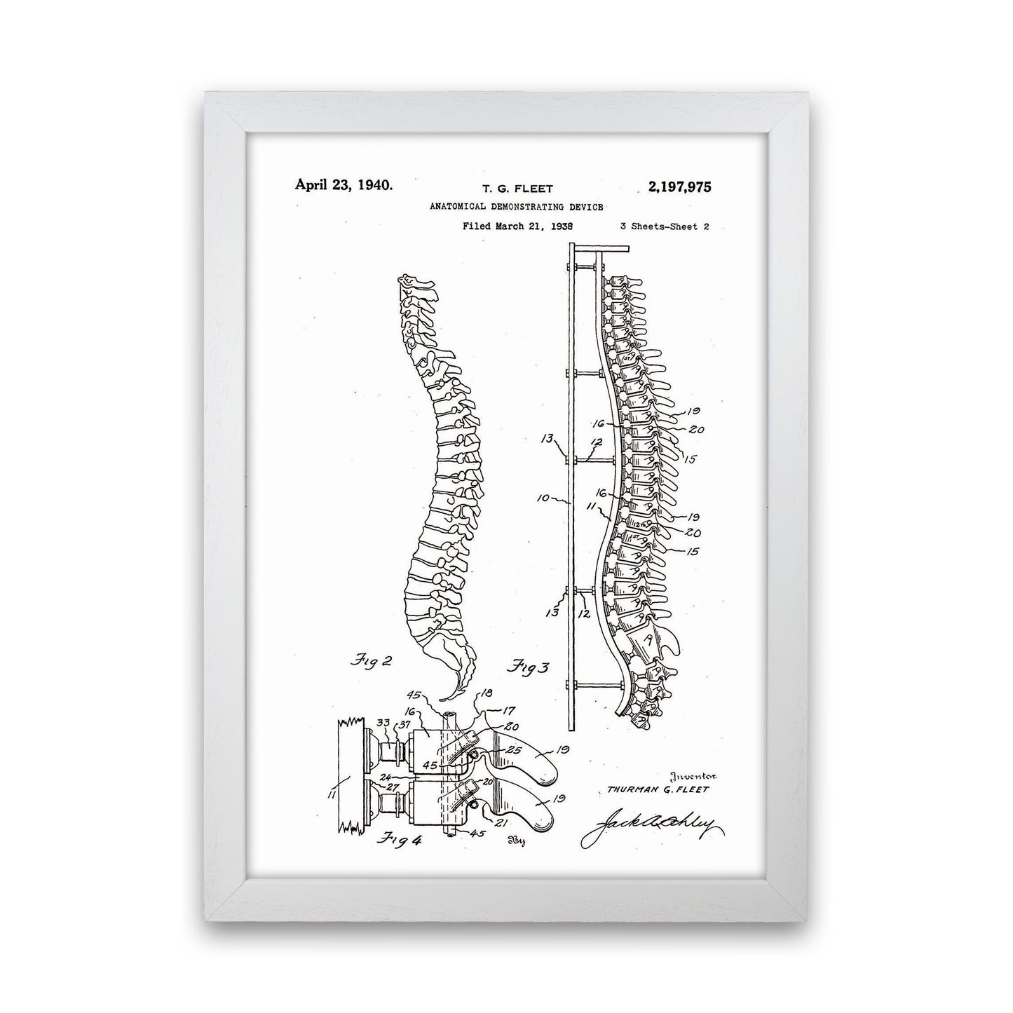 Anatomical Spine Display Patent Art Print by Jason Stanley White Grain
