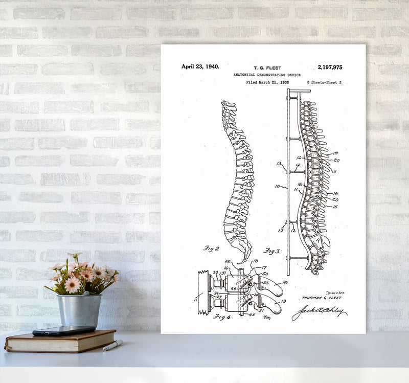 Anatomical Spine Display Patent Art Print by Jason Stanley A1 Black Frame