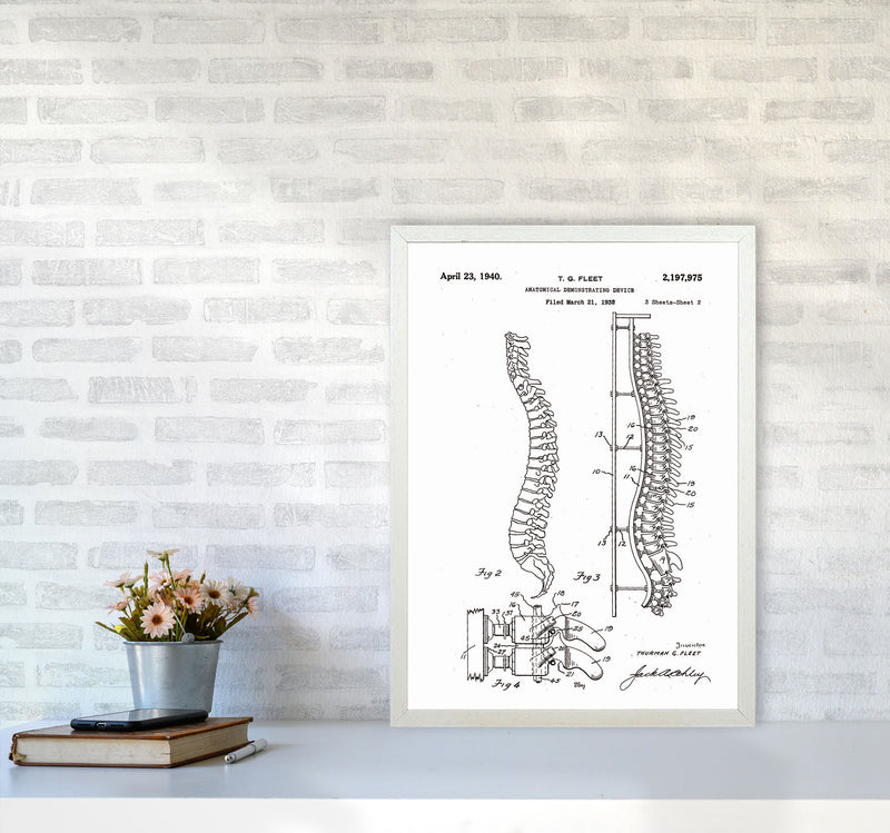 Anatomical Spine Display Patent Art Print by Jason Stanley A2 Oak Frame