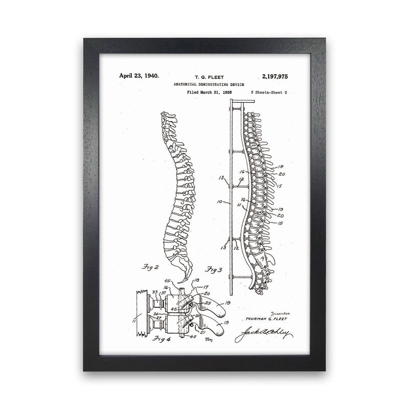 Anatomical Spine Display Patent Art Print by Jason Stanley Black Grain
